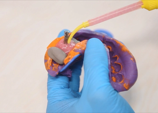 duplicating materials in dentistry