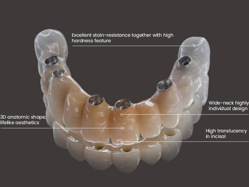 Focus on the Research on Digital Dentistry, to Provide One-Stop Dental Solutions