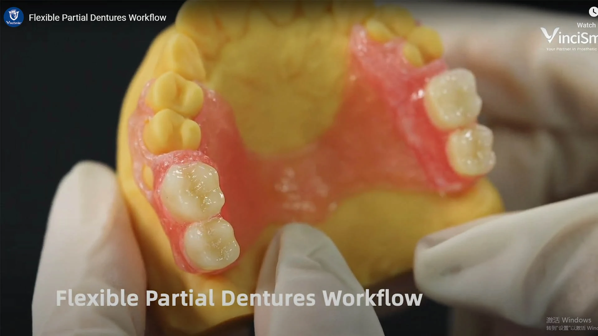 Flexible Partial Dentures Workflow