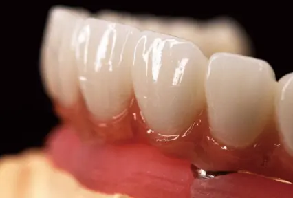 Digital Denture Solution with NOBILCAM MM-4D Zirconia Available!