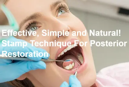 Effective, Simple and Natural! Stamp Technique For Posterior Restoration